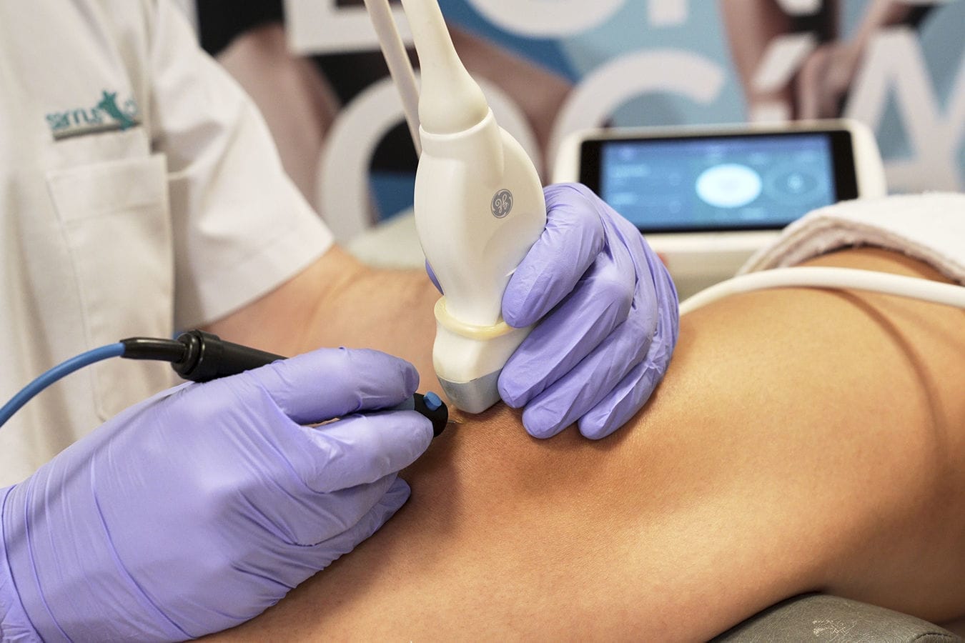 Electrólisis Percutanea (physio-invasiva-2.0)