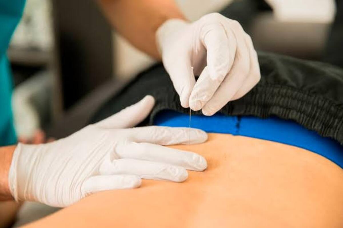 Fisioterapeuta valorando la musculatura del cuello de un paciente antes de aplicar punción seca