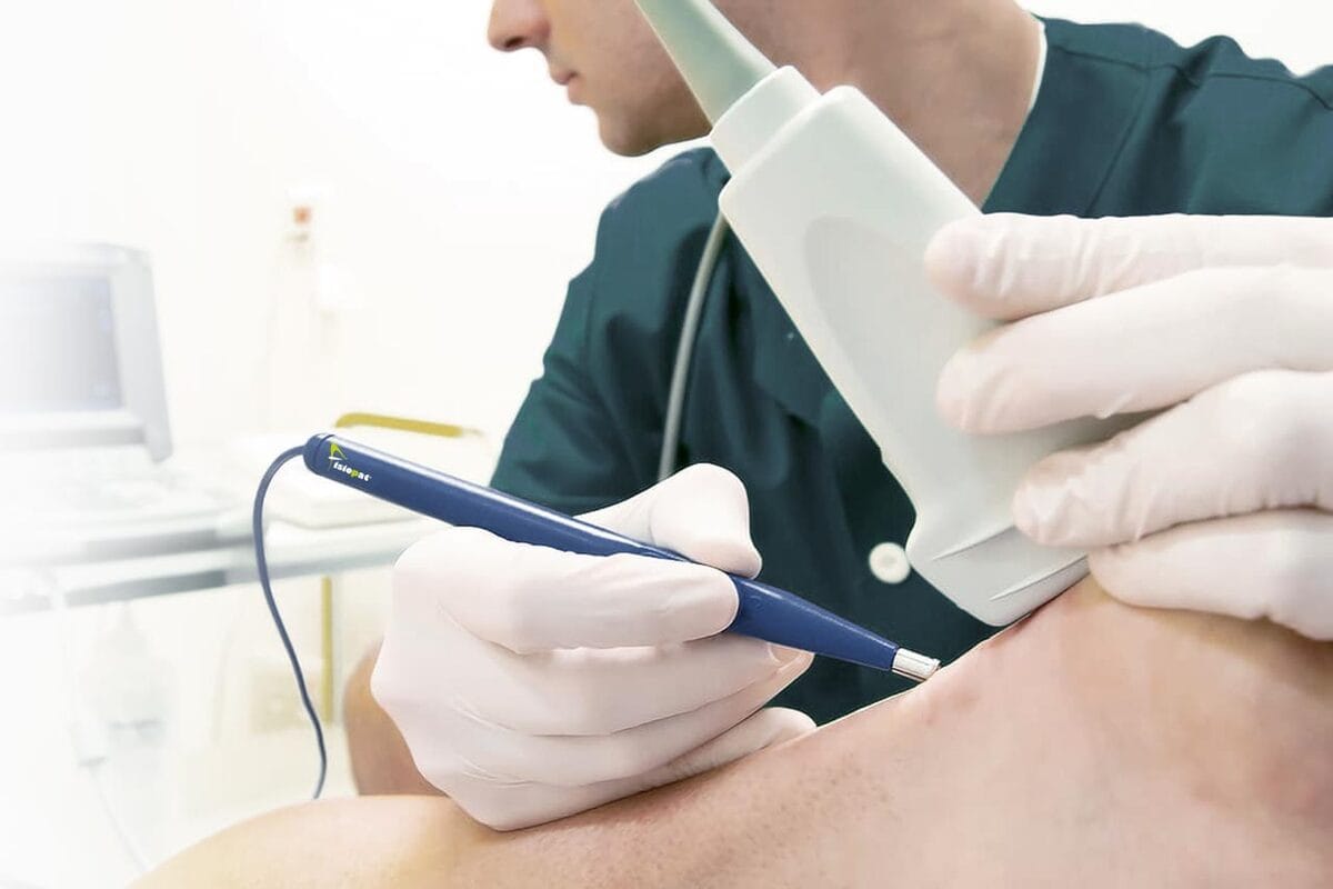 Fisioterapeuta explorando el tendón de aquiles de un deportista antes de aplicar electrólisis percutánea
